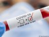 За сутки в Беларуси зарегистрированы 577 пациентов с COVID-19